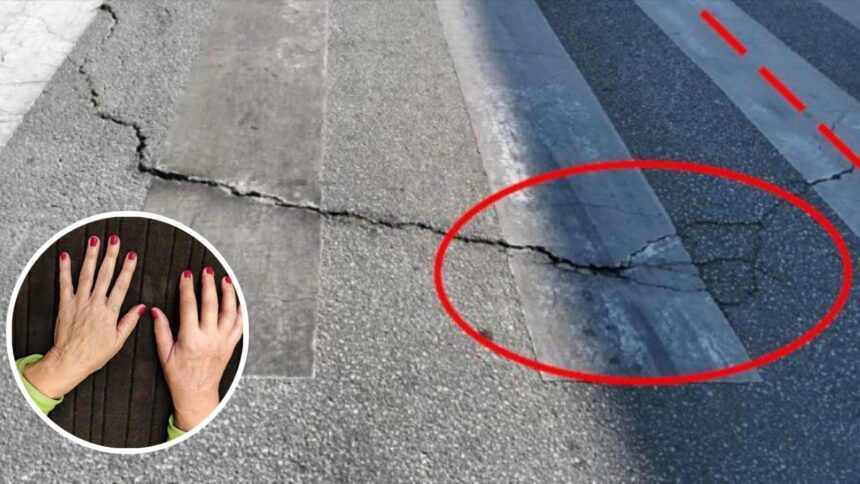Entre Mijas y Fuengirola: la batalla judicial de Ana Sánchez, lesionada por una grieta en la «calle del limbo»