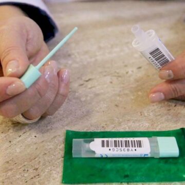Un líquido de limpieza en las probetas, origen de los falsos positivos en el cribado del cáncer de colon en Málaga Un líquido de limpieza en las probetas, origen de los falsos positivos en el cribado del cáncer de colon en Málaga