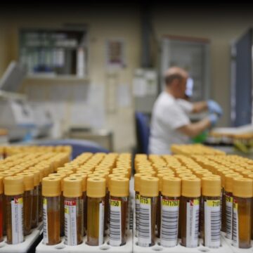 La Fiscalía de Málaga abre diligencias tras la denuncia por falsos positivos de cáncer de colon